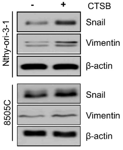 Western blotting for Snail and vimentin in Nthy-ori-3-1 and 8505C cells after treatment with recombinant CTSB.jpg